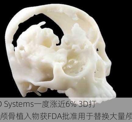 3D Systems一度涨近6% 3D打印颅骨植入物获FDA批准用于替换大量颅骨