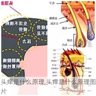 头痒是什么原理,头痒是什么原理图片